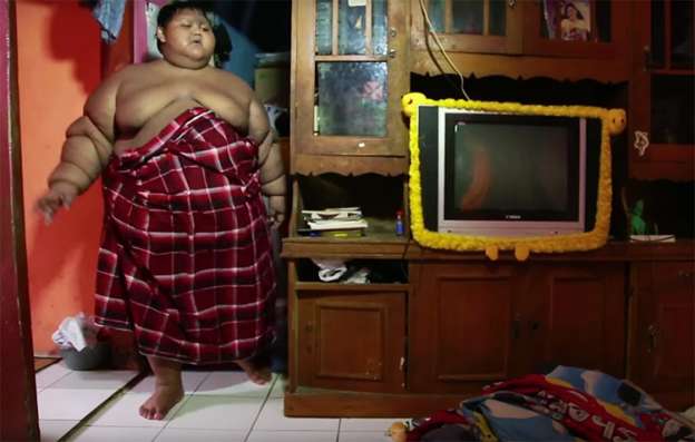 Niño de 10 años es el más gordo del mundo, pesa 191 kilos 