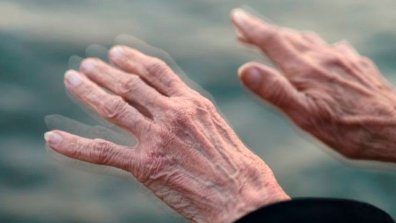 Enfermedad de Parkinson, segundo lugar entre los padecimientos neurodegenerativos en México 