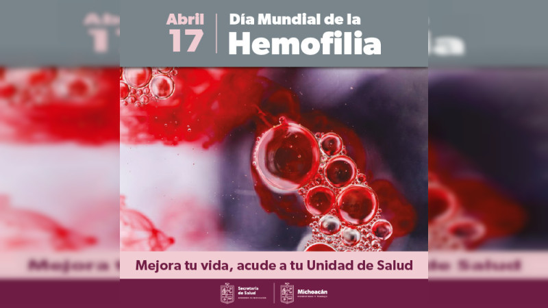 Ofrece SSM tratamiento innovador y gratuito a pacientes con hemofilia 