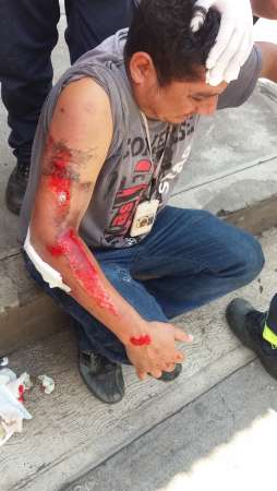  El choque de dos motocicletas dejó como saldo un herido en los Reyes  - Foto 0 