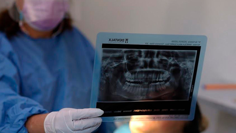 Otorga Salud Michoacán más 30 mil consultas dentales gratuitas en primer trimestre de 2023