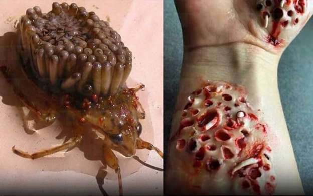 Picadura de esta nueva especie de insecto podría llevar a la muerte  