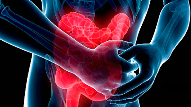 Hospitales Juárez y General de México cuentan con nuevas clínicas de Enfermedad Inflamatoria Intestinal 
