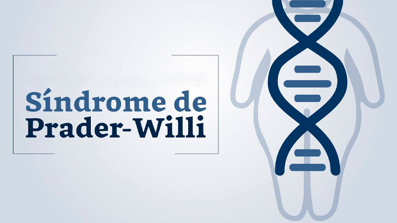 Síndrome de Prader Willi, alteración genética que ocasiona falta de saciedad y talla baja 