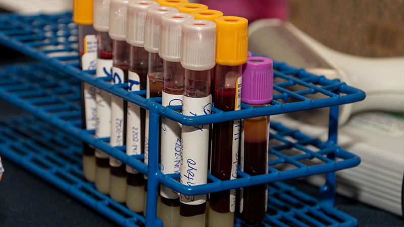Promueve DIF Michoacán cultura de donación de sangre