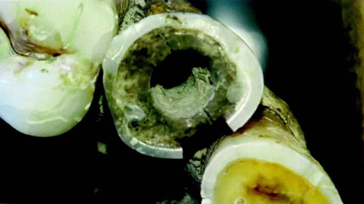 Michoacán: Servicio Arqueomagnético Nacional de la UNAM confirma el tratamiento dental más antiguo en América - Foto 0 