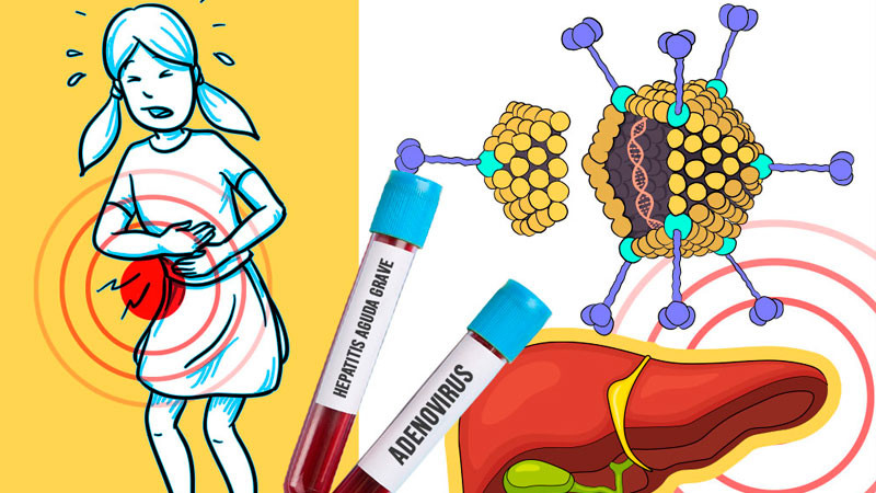 Invita SSM a detectar síntomas para la prevención de hepatitis A 