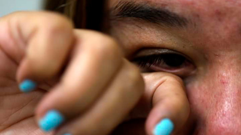 Ojos rojos y picazón en los ojos, podría ser conjuntivitis, advierte Salud Michoacán