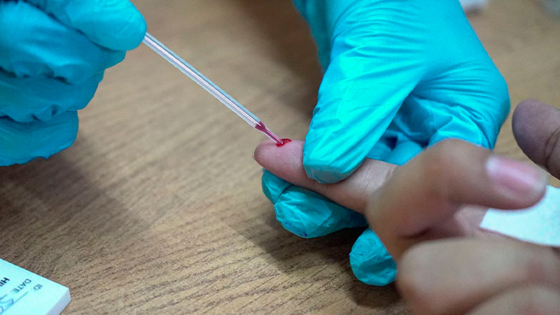 Garantiza Salud Michoacán tratamiento gratuito a pacientes con hepatitis C
