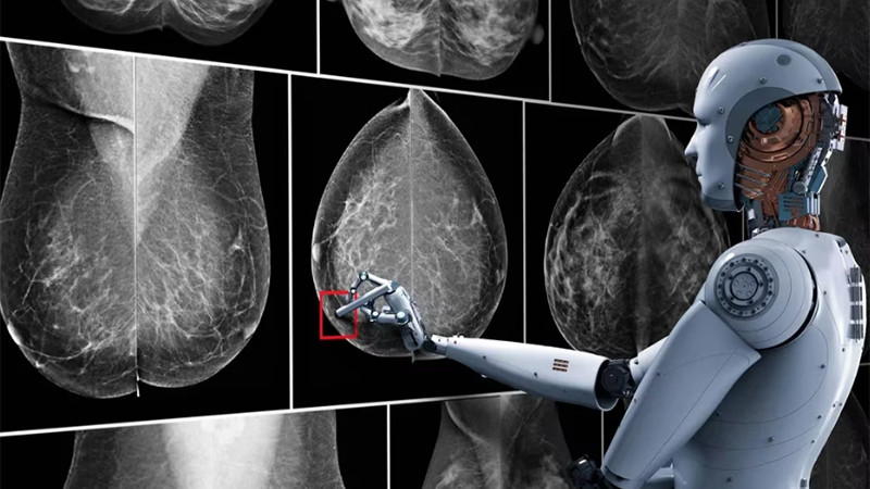 Inteligencia Artificial podría ayudar a detectar el cáncer de mama 
