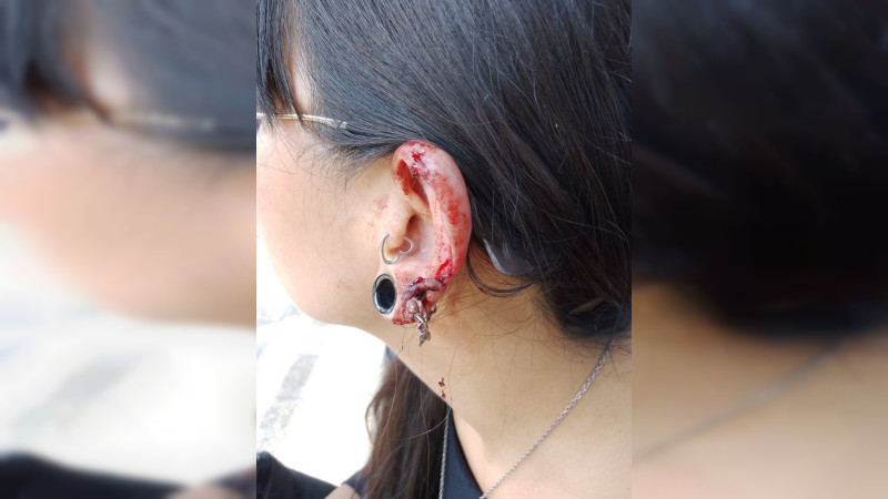 Sujeto arranca pedazo de oreja a mujer al interior de un Metrobús en la CDMX