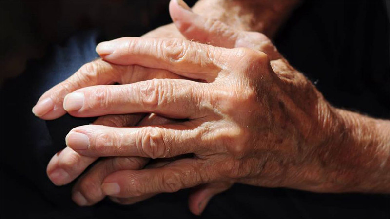 Estudio advierte: la osteoartritis afectará a mil millones de personas para 2050 