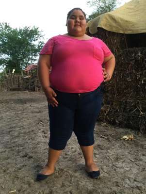 Dayana Camacho, la niña mexicana de 14 años que pesa 430 libras - Foto 0 