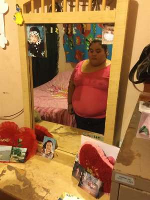 Dayana Camacho, la niña mexicana de 14 años que pesa 430 libras - Foto 1 