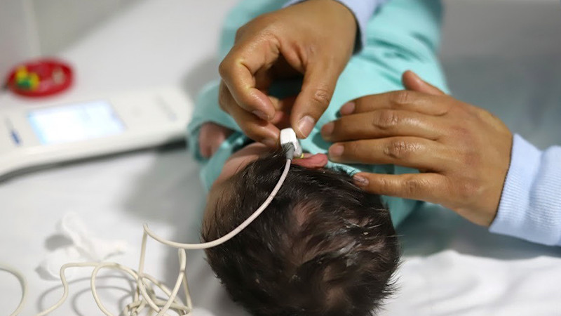 Arranca programa de implantes auditivos gratuitos para menores de 6 años: SSM 