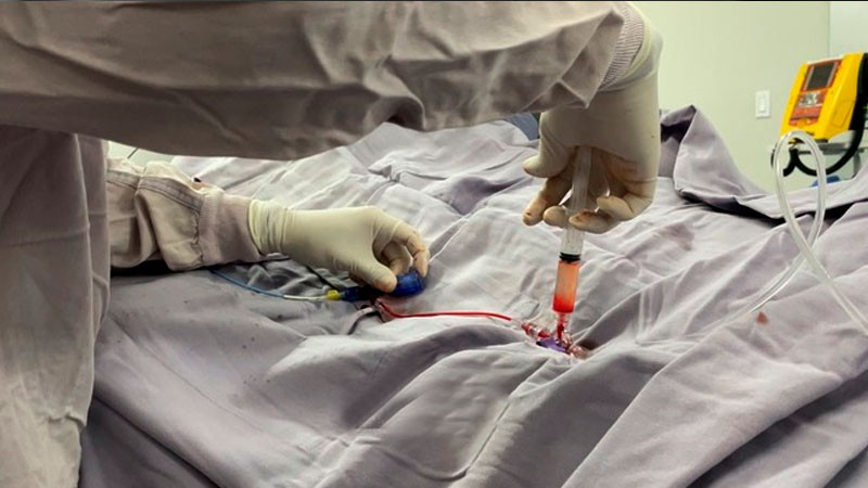Código Infarto en Hospital General de México contribuye a salvar vidas 