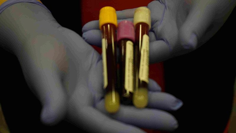 Estos son los requisitos para convertirte en donador altruista de sangre
