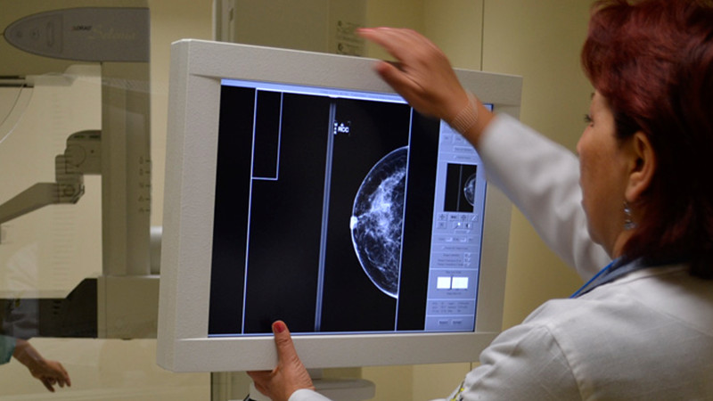 Salud Michoacán anuncia mastografías gratuitas en 19 municipios de Michoacán 