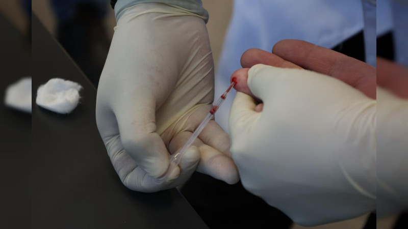 De 10 casos, siete resultan positivos a cáncer de próstata: Dulce Ventura 