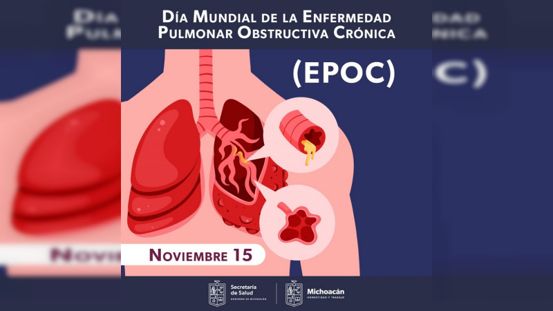 Detecta estos signos de alarma para prevenir la Enfermedad Pulmonar Obstructiva Crónica 
