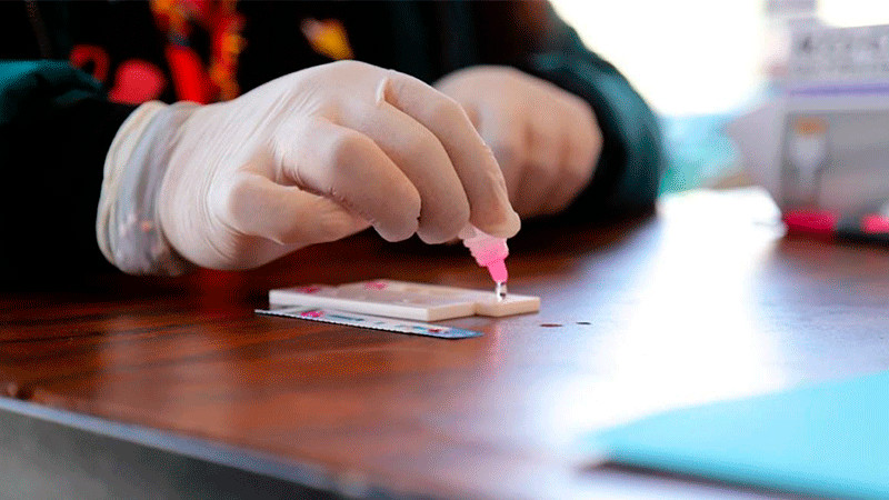 Este viernes SSM realizará pruebas rápidas de VIH en Morelia 