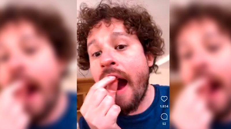 Luisito Comunica pierde los dientes en transmisión en vivo  