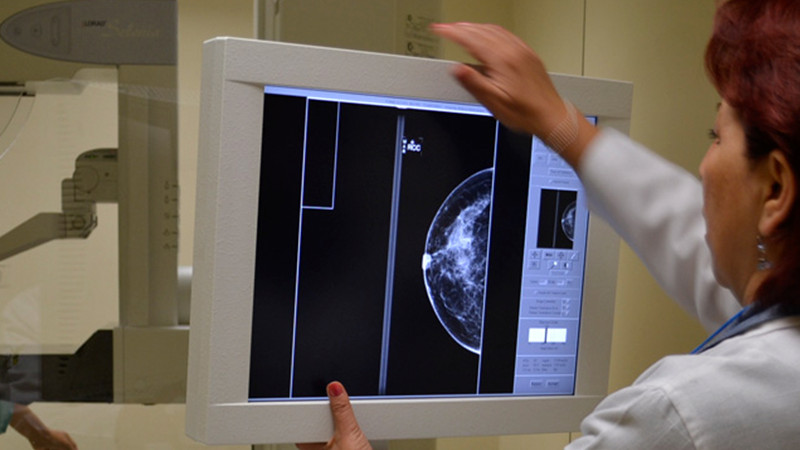 Mantendrá Salud Michoacán mastografías gratuitas en Uneme Dedicam durante las vacaciones 