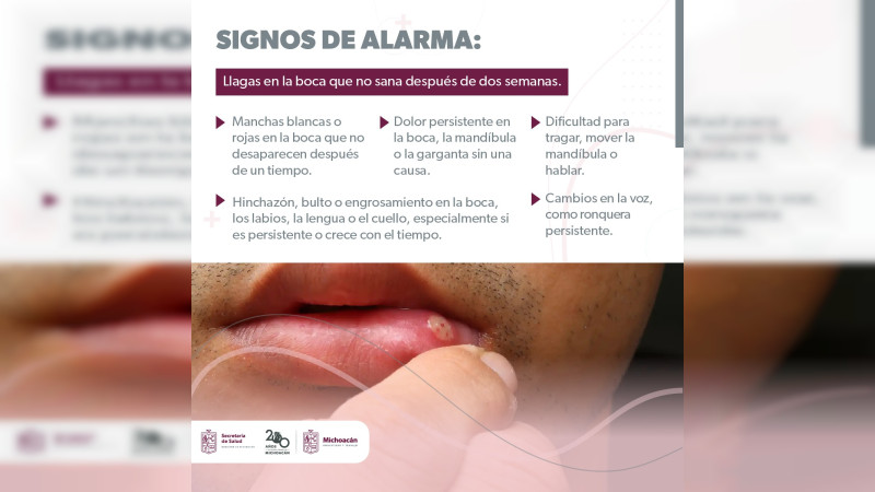 Sector Salud Michoacán advierte sobre hábitos que te pueden provocar cáncer de boca y lengua 