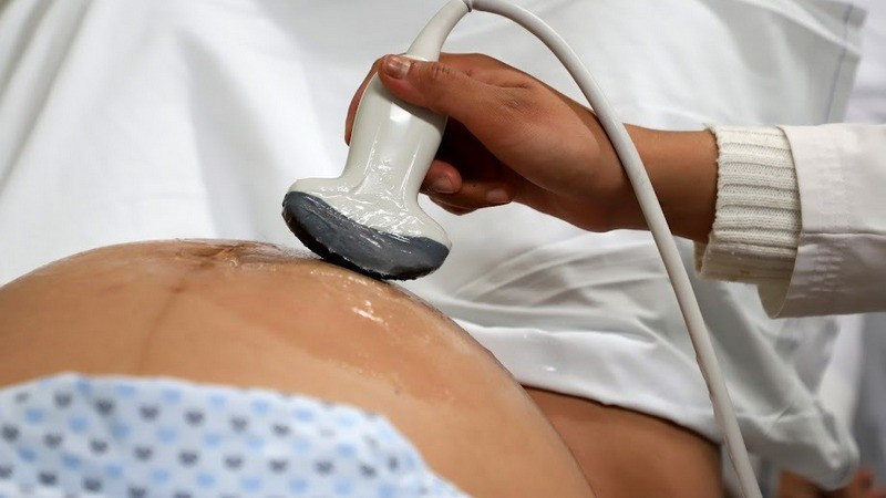 Control prenatal, primordial en la prevención de la muerte materna 