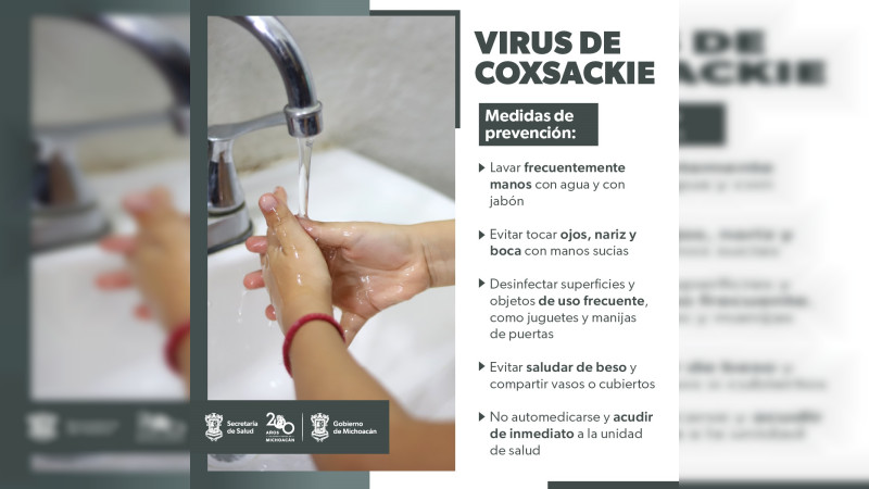 Conoce cómo prevenir el virus coxsackie que afecta a menores de 5 años