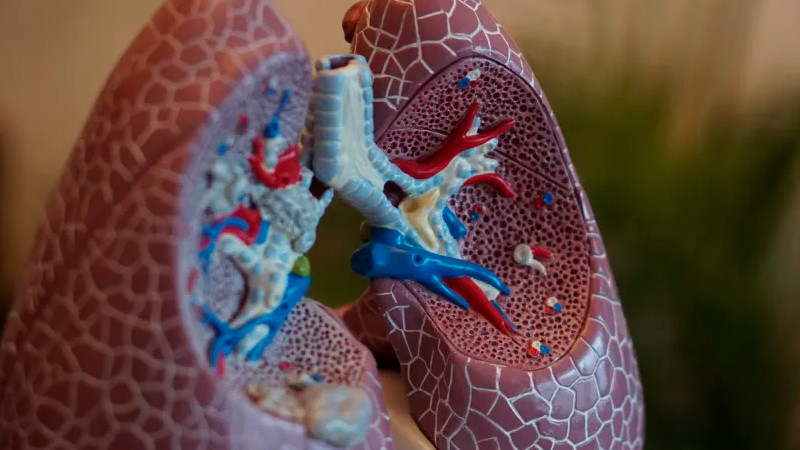 Detectan casos de tuberculosis entre migrantes recién llegados a Chicago 
