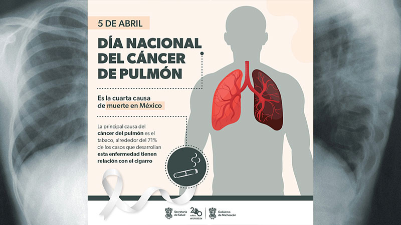 Radiografía de tórax para detener el cáncer de pulmón: Secretaría de Salud 