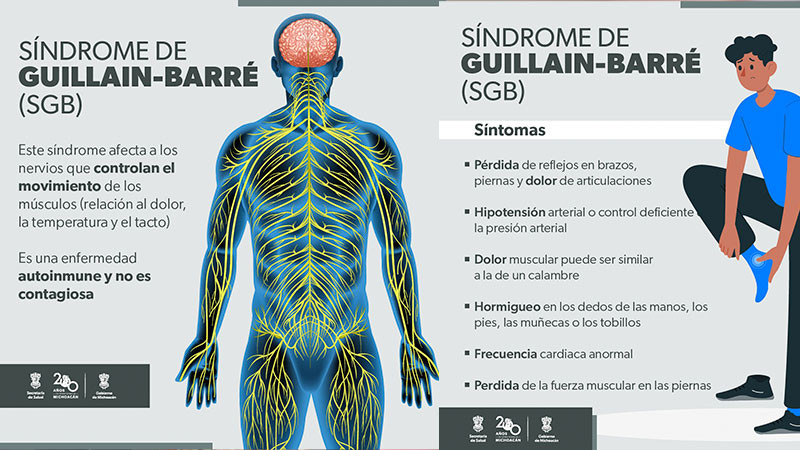 Así se siente el síndrome de Guillain-Barré; el cual puede prevenirse con medidas de higiene 