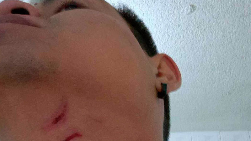 Inicia la CEDH Michoacán queja por brutalidad policial de Uruapan