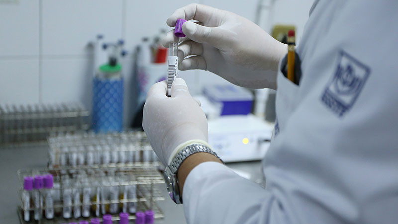 Issste garantiza a derechohabientes tratamiento para hemofilia  