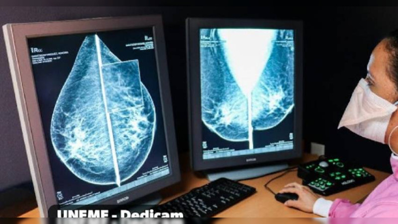 Mastectomía, método preventivo para el cáncer de mama en mujeres con antecedentes familiares