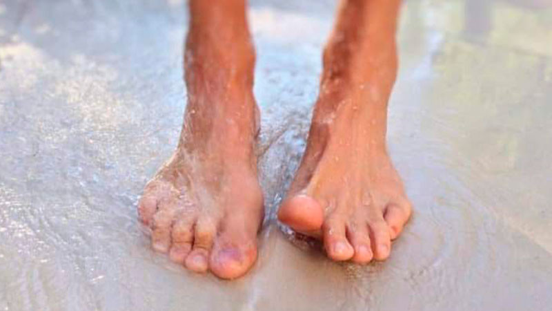 Sector salud da recomendaciones para prevenir el pie de atleta  