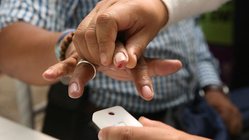 Hospital “20 de Noviembre” detecta 60 por ciento de casos de cáncer de próstata en etapa curable: Issste 