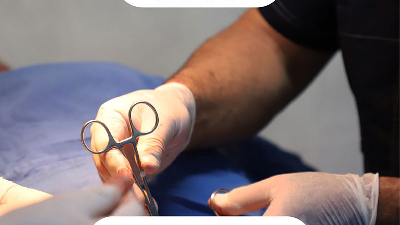 Sector salud anuncia vasectomías gratuitas en Acuitzio, Ario y Tlalpujahua 