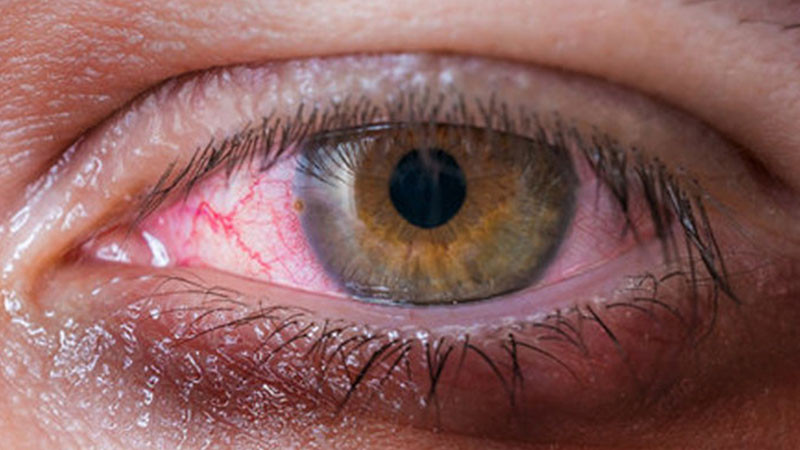 El impacto silencioso del consumo de drogas en la salud visual 