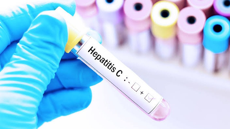 Detección y tratamiento adecuado para hepatitis C, previene complicaciones: Sector Salud 