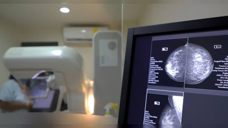 Realizadas más de 22 mil mastografías en 2024: sector salud 