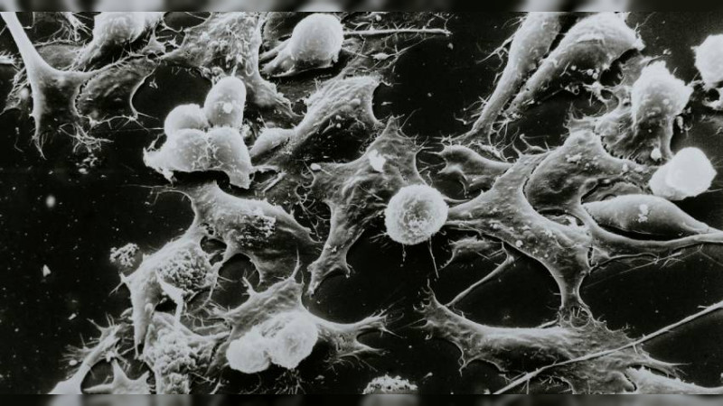 Conoce los signos y síntomas del cáncer cervicouterino