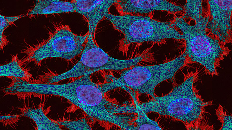 Sector salud cuenta con 7 clínicas de colposcopia para detectar cáncer cervicouterino 