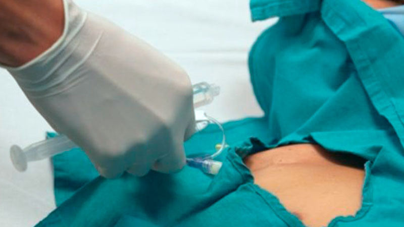 Cuenta sector salud con diez clínicas de catéter para un mejor cuidado de pacientes 