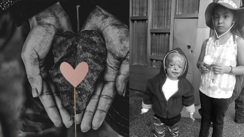 Padre de Chuchito, pide ayuda para la atención médica de su niño 