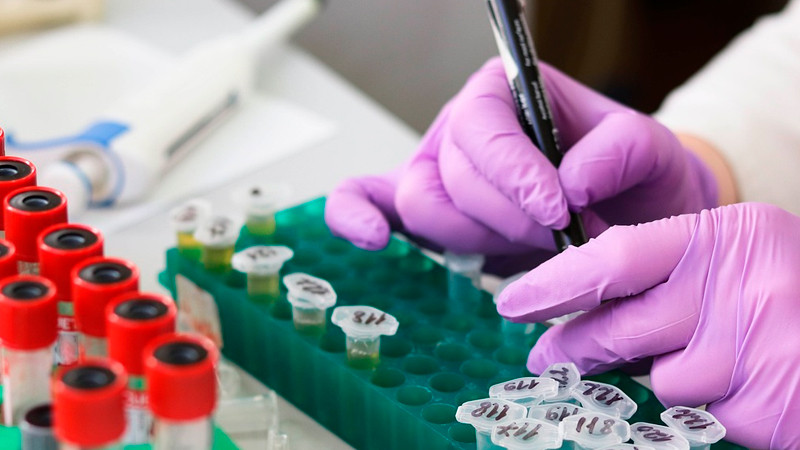 Enfermedad desconocida cobra vida de 71 personas en RDC; activan alerta máxima 