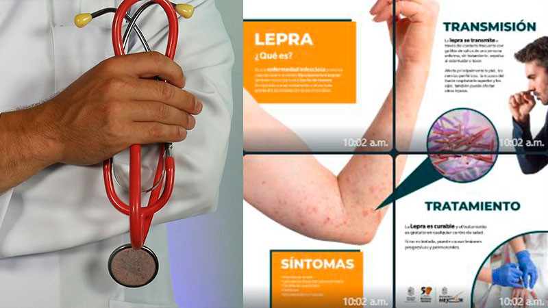 Sector salud se suma a acciones de lucha contra la lepra 