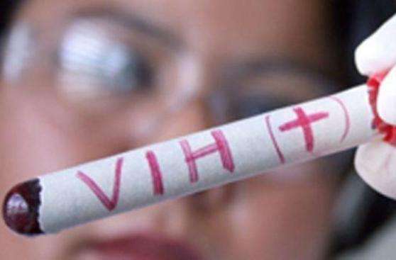 40 por ciento  de los mexicanos portadores de VIH desconocen su enfermedad 