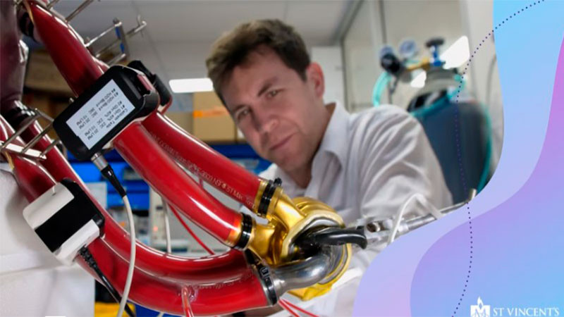 Vive australiano más de 100 días con un corazón artificial de titanio 
